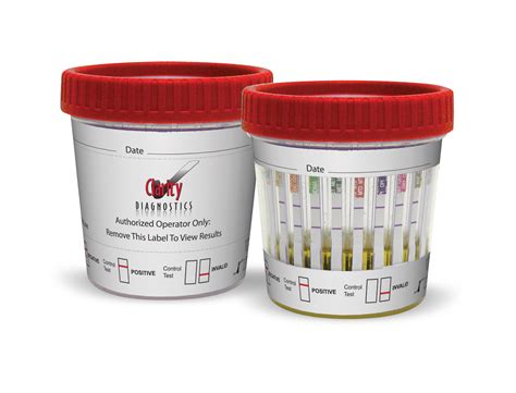 urinary drug of abuse test